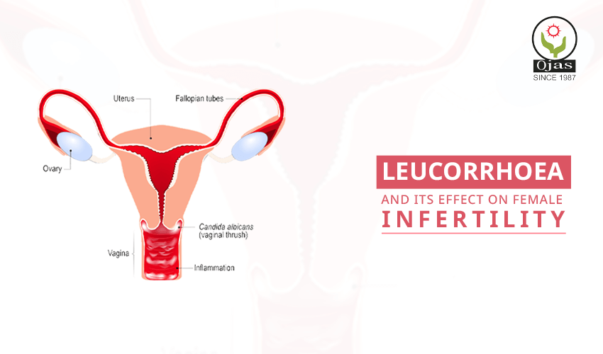 Leucorrhoea effect on female fertility