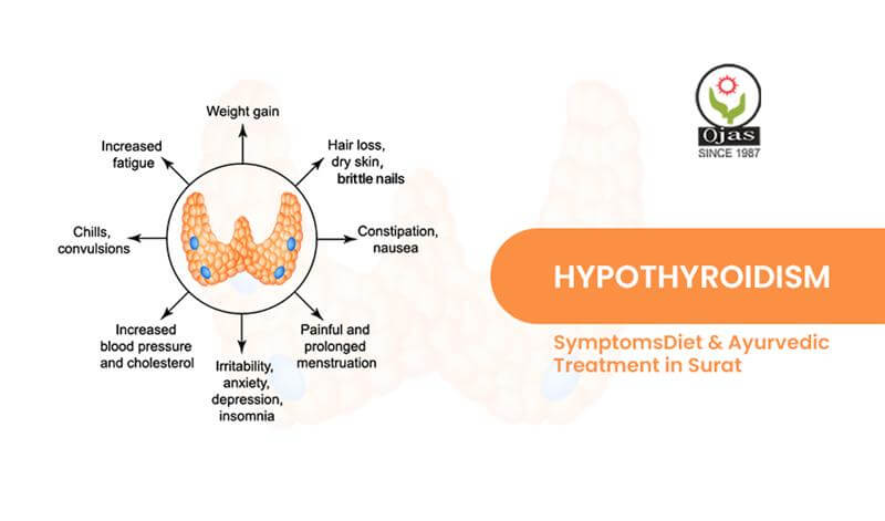 Hypothyroidism Ayurvedic Treatment Surat