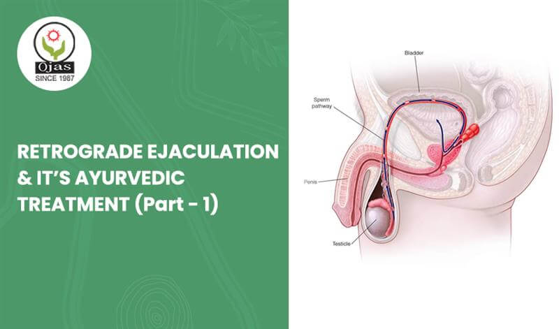 Retrograde Ejaculation Ayurvedic Treatment -1